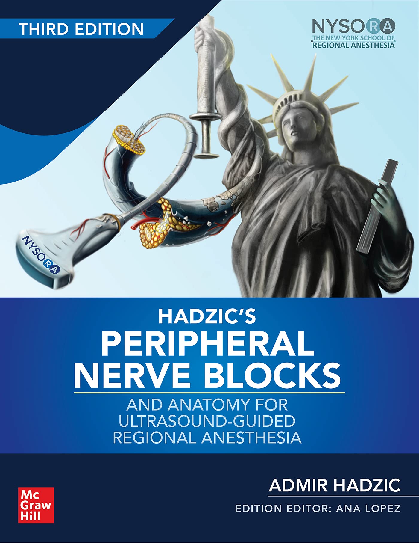 hadzics-peripheral-nerve-blocks-and-anatomy-for-ultrasound-guided-regional-anesthesia