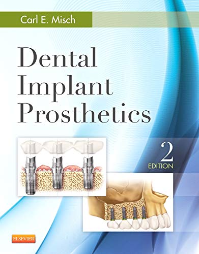 dental-implant-prosthetics