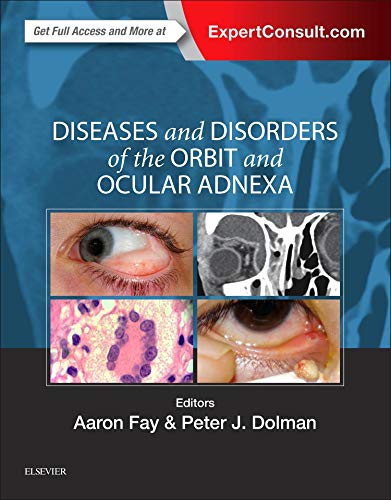 diseases-and-disorders-of-the-orbit-and-ocular-adnexa-expert-consult-online-and-print-1e