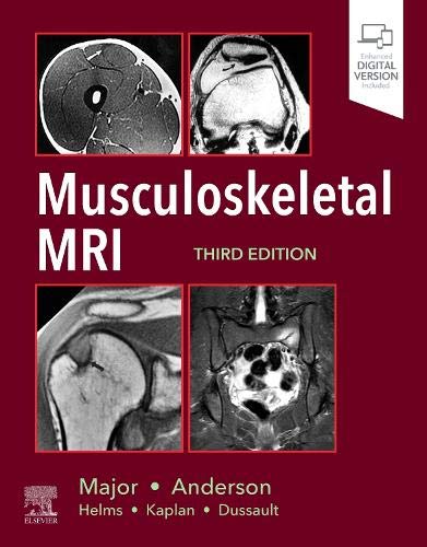 musculoskeletal-mri-3e