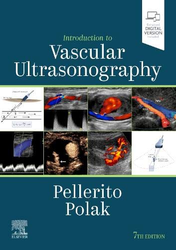 introduction-to-vascular-ultrasonography-expert-consult-online-and-print-7e