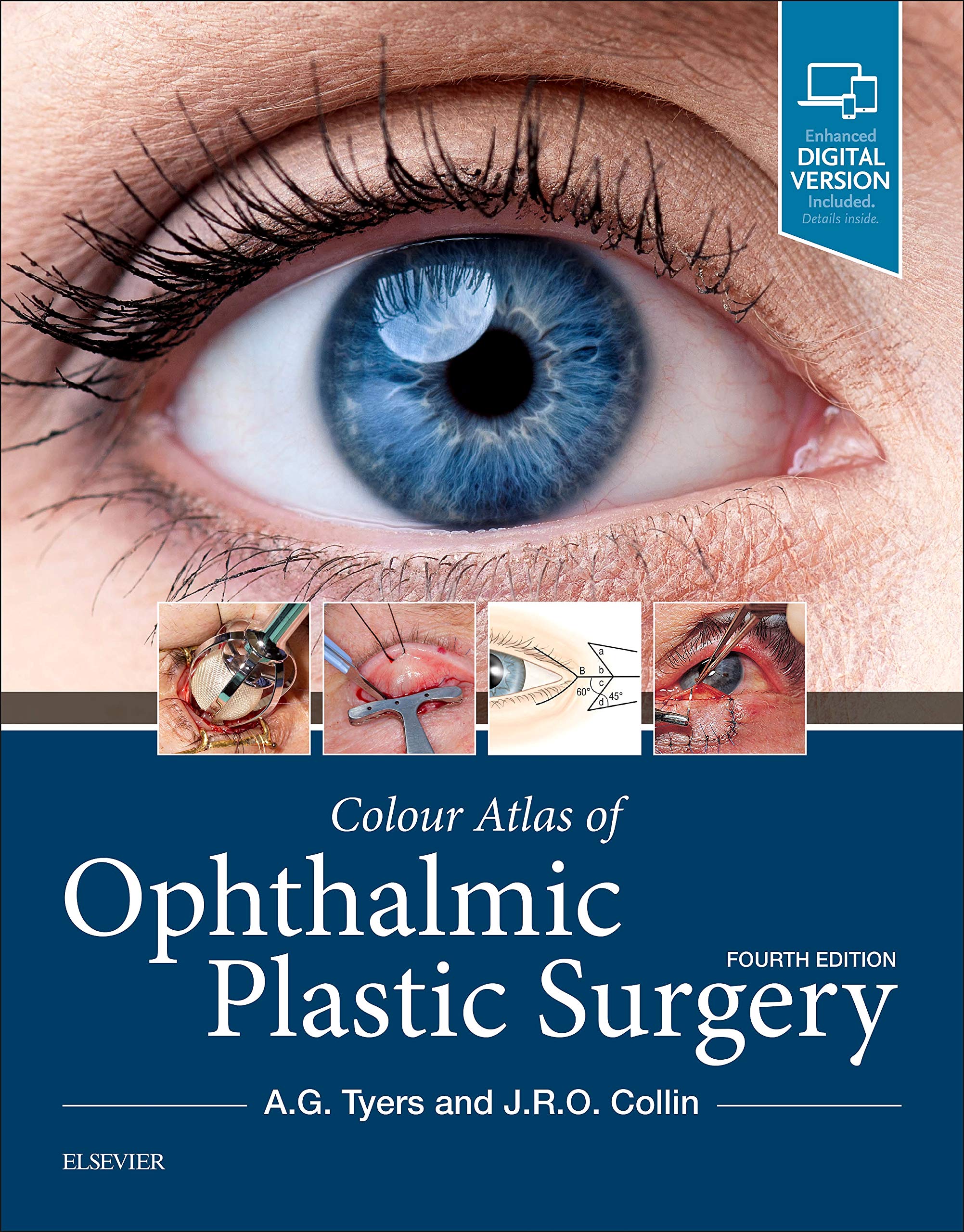 4 surgery. Color Atlas of ophthalmic Plastic Surgery. Emergency Ophthalmology. Books. Larry Benjamin FRCS FRCOPHTH do Cataract Surgery.