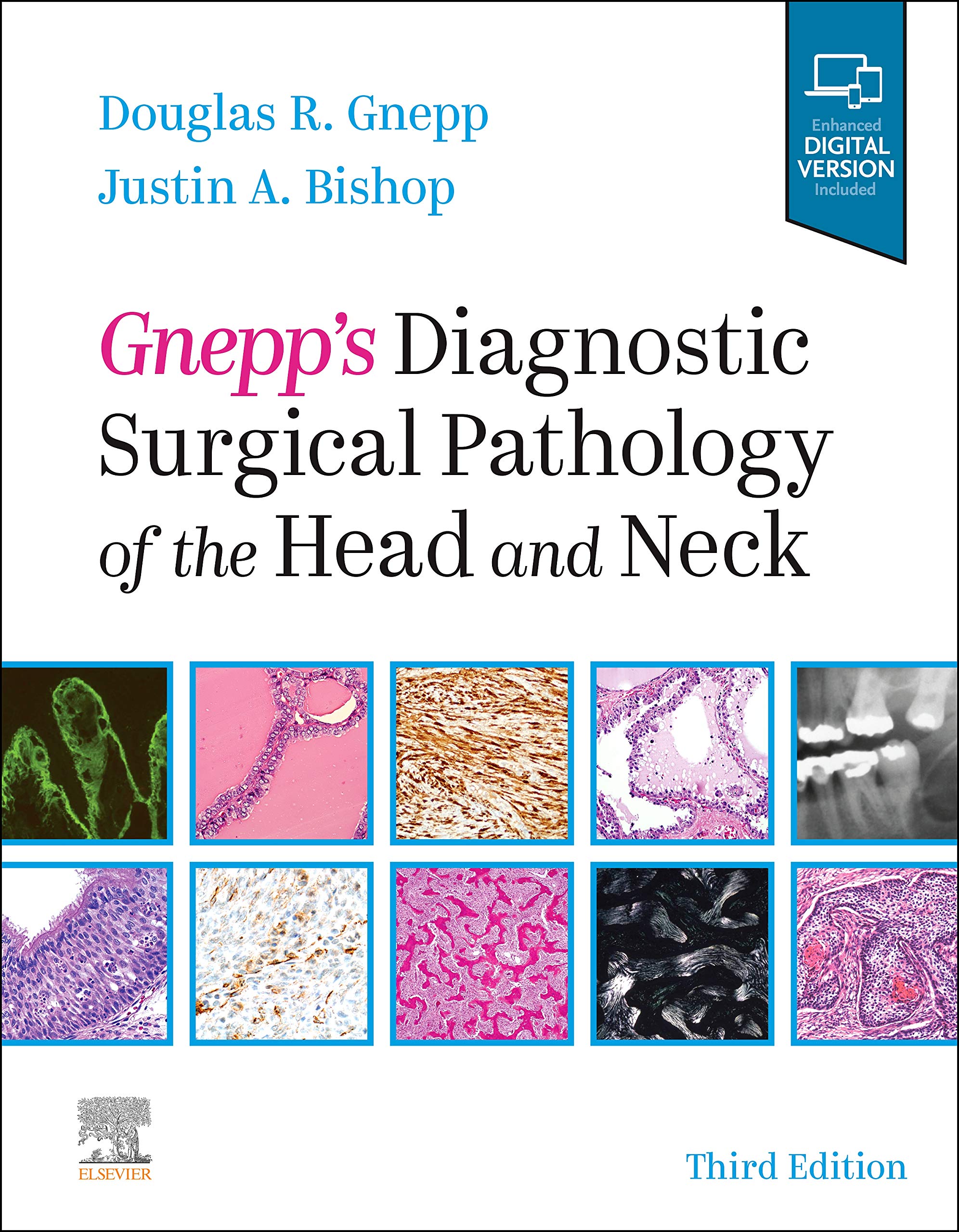 gnepps-diagnostic-surgical-pathology-of-the-head-and-neck