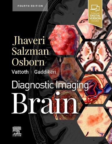diagnostic-imaging-brain