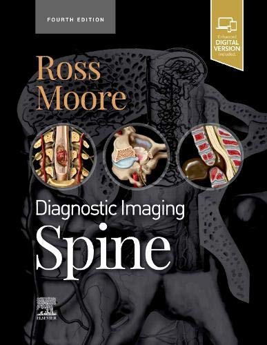 diagnostic-imaging-spine