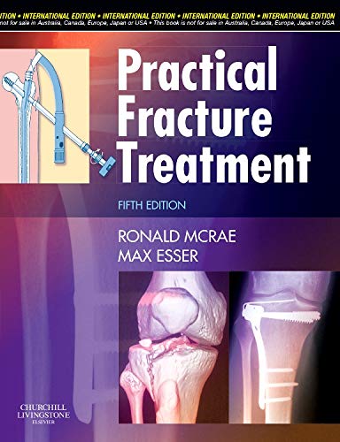practical-fracture-treatment-international-edition-5e