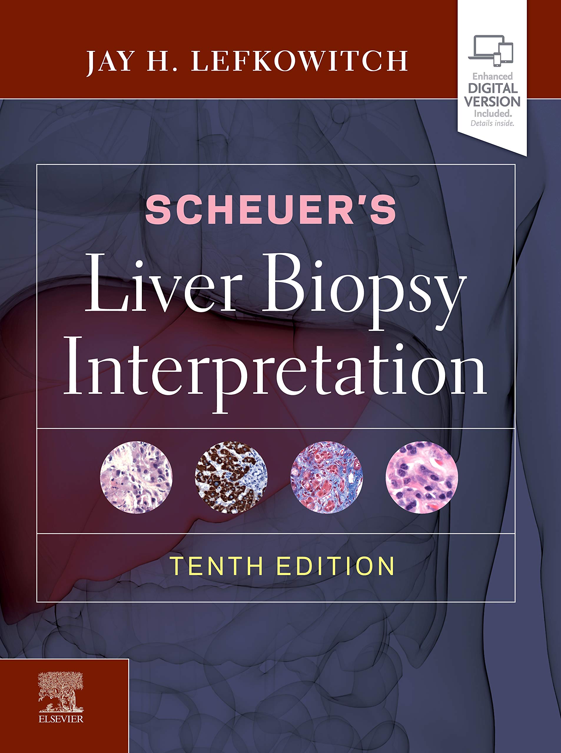 scheuers-liver-biopsy-interpretation