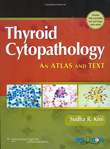 thyroid-cytopathology-old-edition