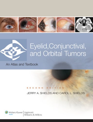 eyelid-conjunctival-and-orbital-tumors-2ed-2-vol-set-old-edition