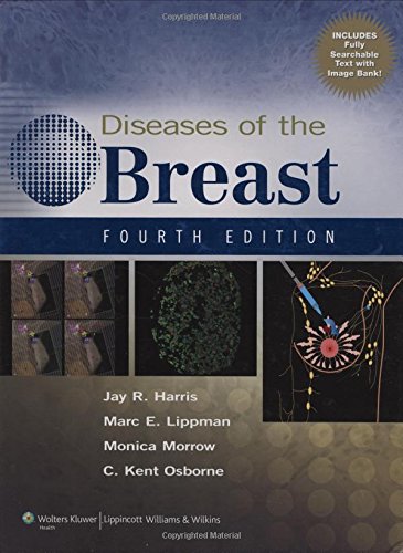 diseases-of-the-breast-4ed-old-edition
