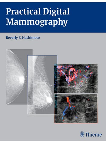 practical-digital-mammography-1e