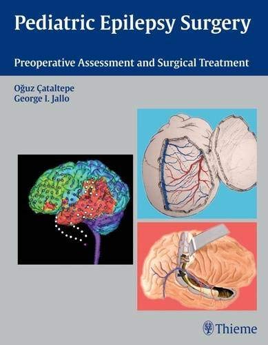 pediatric-epilepsy-surgery-preoperative-assessment-and-surgical-treatment