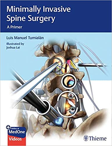 minimally-invasive-spinal-surgery-1e