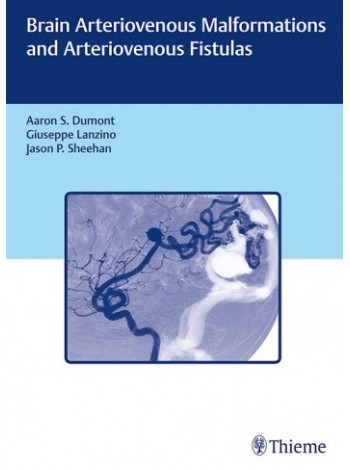 brain-arteriovenous-malformations-and-arteriovenous-fistulas-1e