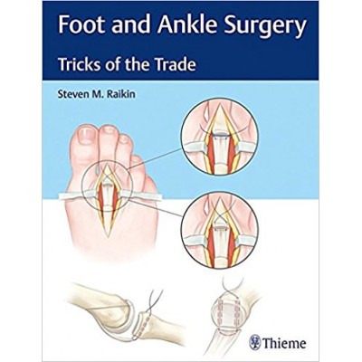 foot-and-ankle-surgery-tricks-of-the-trade-1-edition