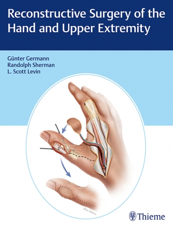 reconstructive-surgery-of-the-hand-and-upper-extremity-1e