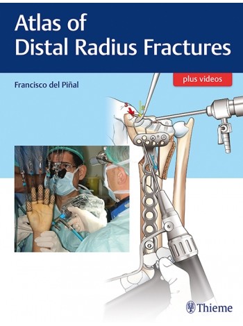 atlas-of-distal-radius-fractures-1e