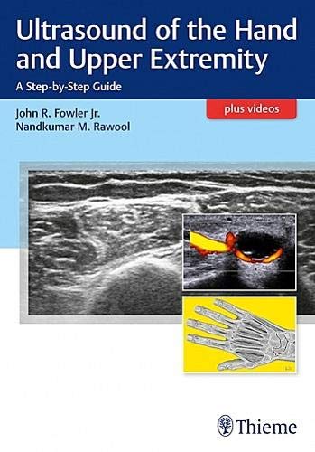 ultrasound-of-the-hand-and-upper-extremity-a-step-by-step-guide-1e