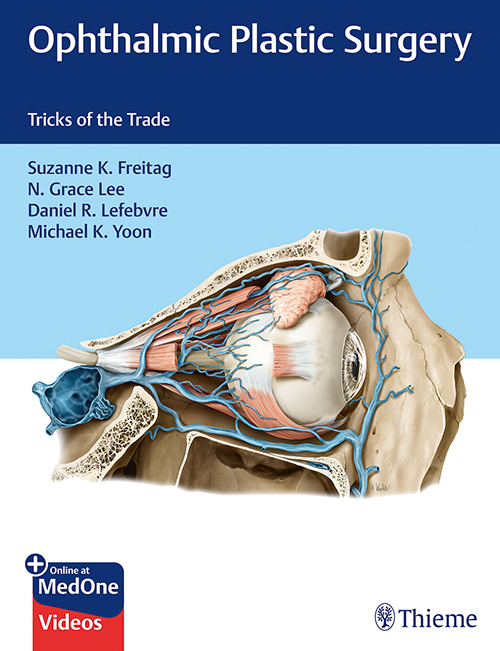 ophthalmic-plastic-surgery-1e