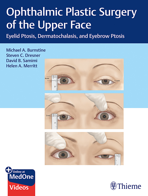 ophthalmic-plastic-surgery-of-the-upper-face-1e