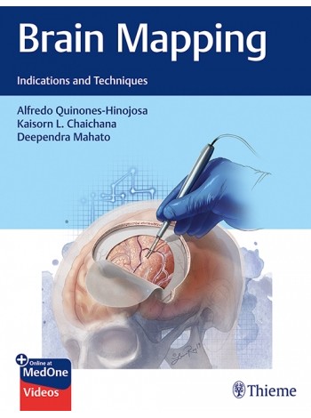 brain-mapping-indications-and-techniques-1e