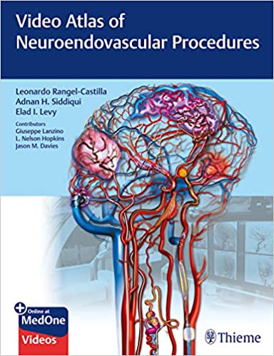video-atlas-of-neuroendovascular-procedures-