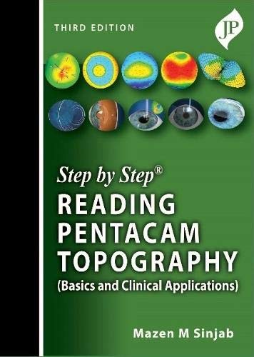 step-by-step-reading-pentacam-topography-basics-and-clinical-applications