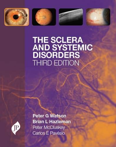 the-sclera-and-systemic-disorders