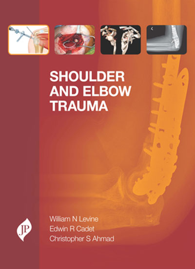shoulder-and-elbow-trauma