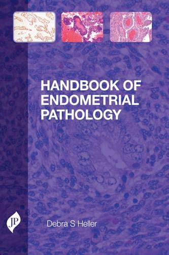 handbook-of-endometrial-pathology