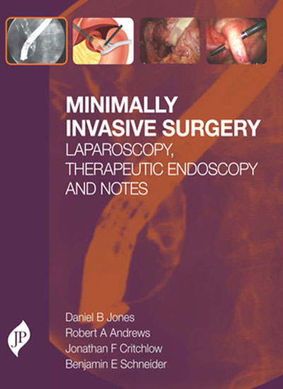 minimally-invasive-surgery-laparoscopytherapeutic-endoscopy-and-notes