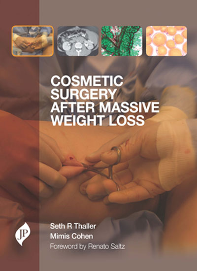 cosmetic-surgery-after-massive-weight-loss