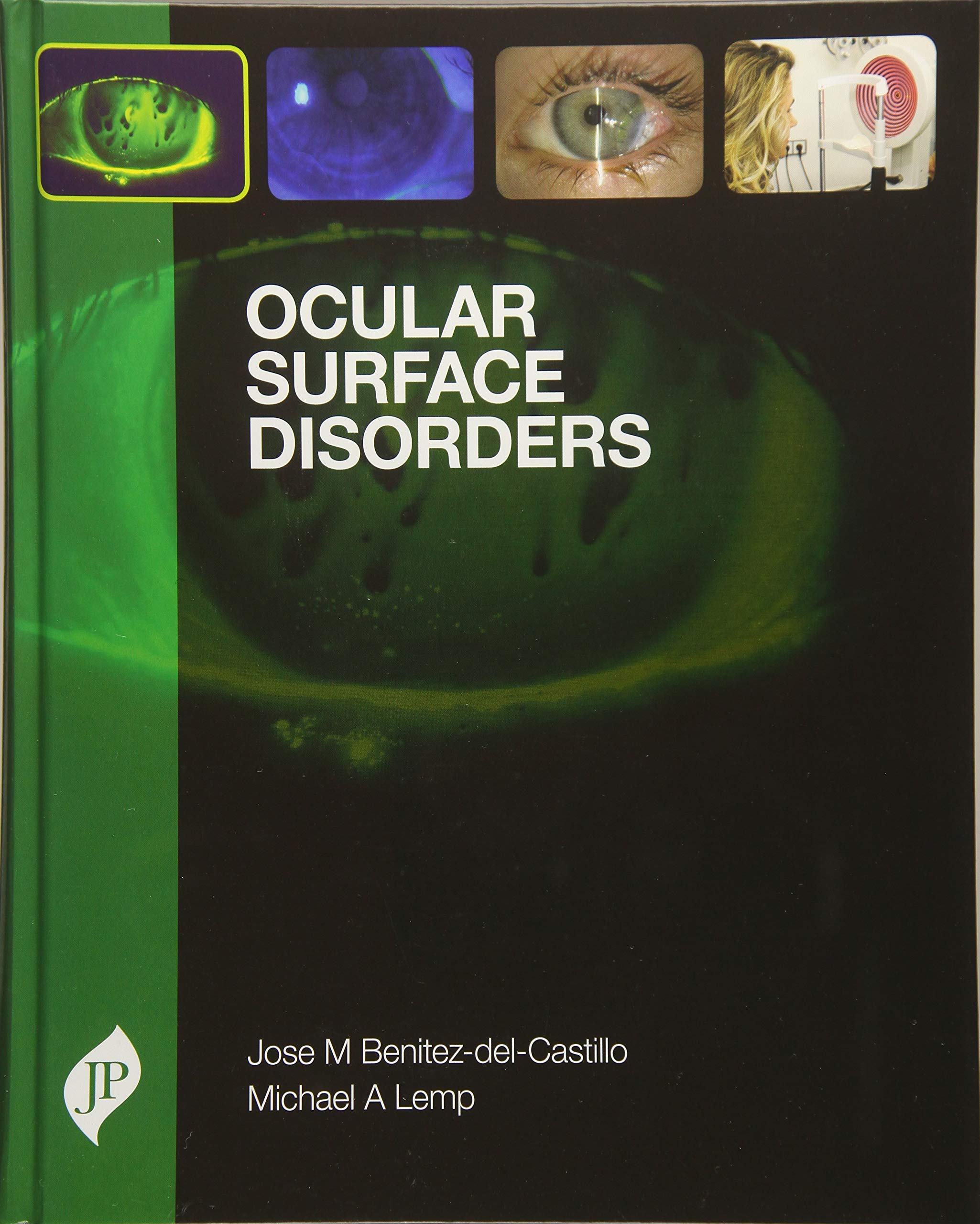 ocular-surface-disorders