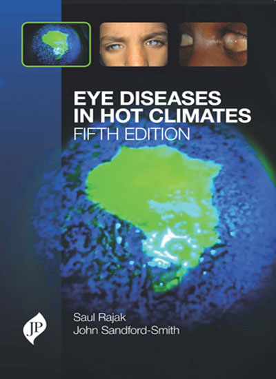 eye-diseases-in-hot-climates