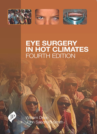 eye-surgery-in-hot-climates
