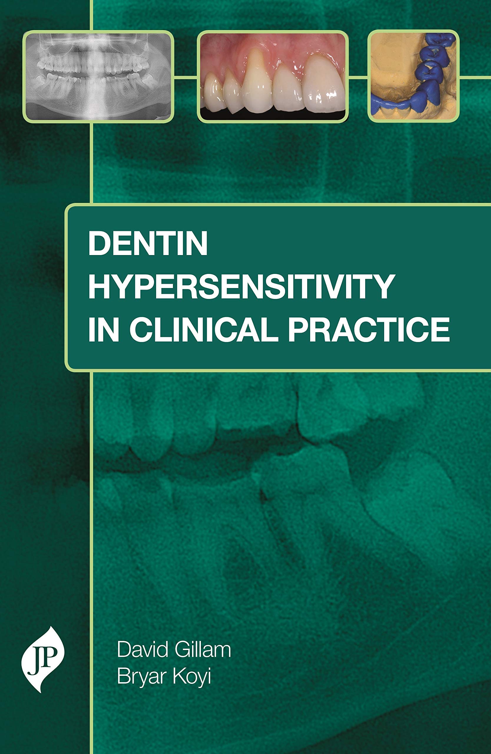 dentin-hypersensitivity-in-clinical-practice