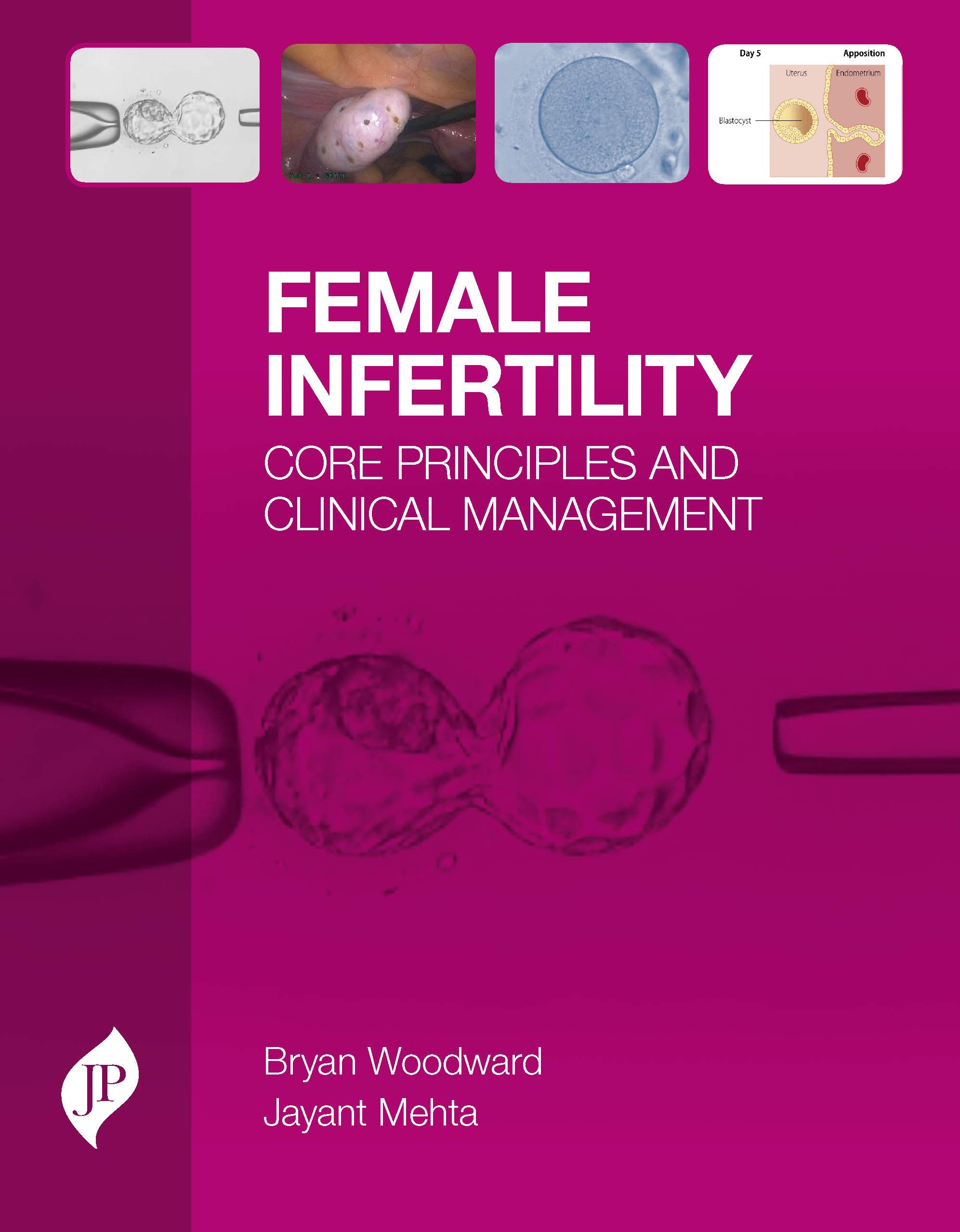 female-infertilty-core-principles-and-clinical-management