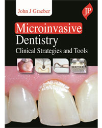 microinvasive-dentistry-clinical-strategies-and-tools