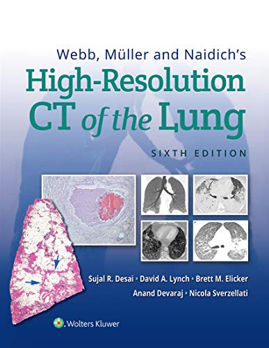 webb-mller-and-naidichs-high-resolution-ct-of-the-lung-8ed-hb-2021