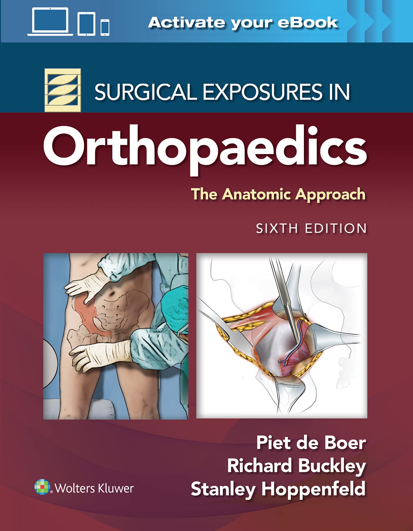 surgical-exposures-in-orthopaedics-the-anatomic-approach