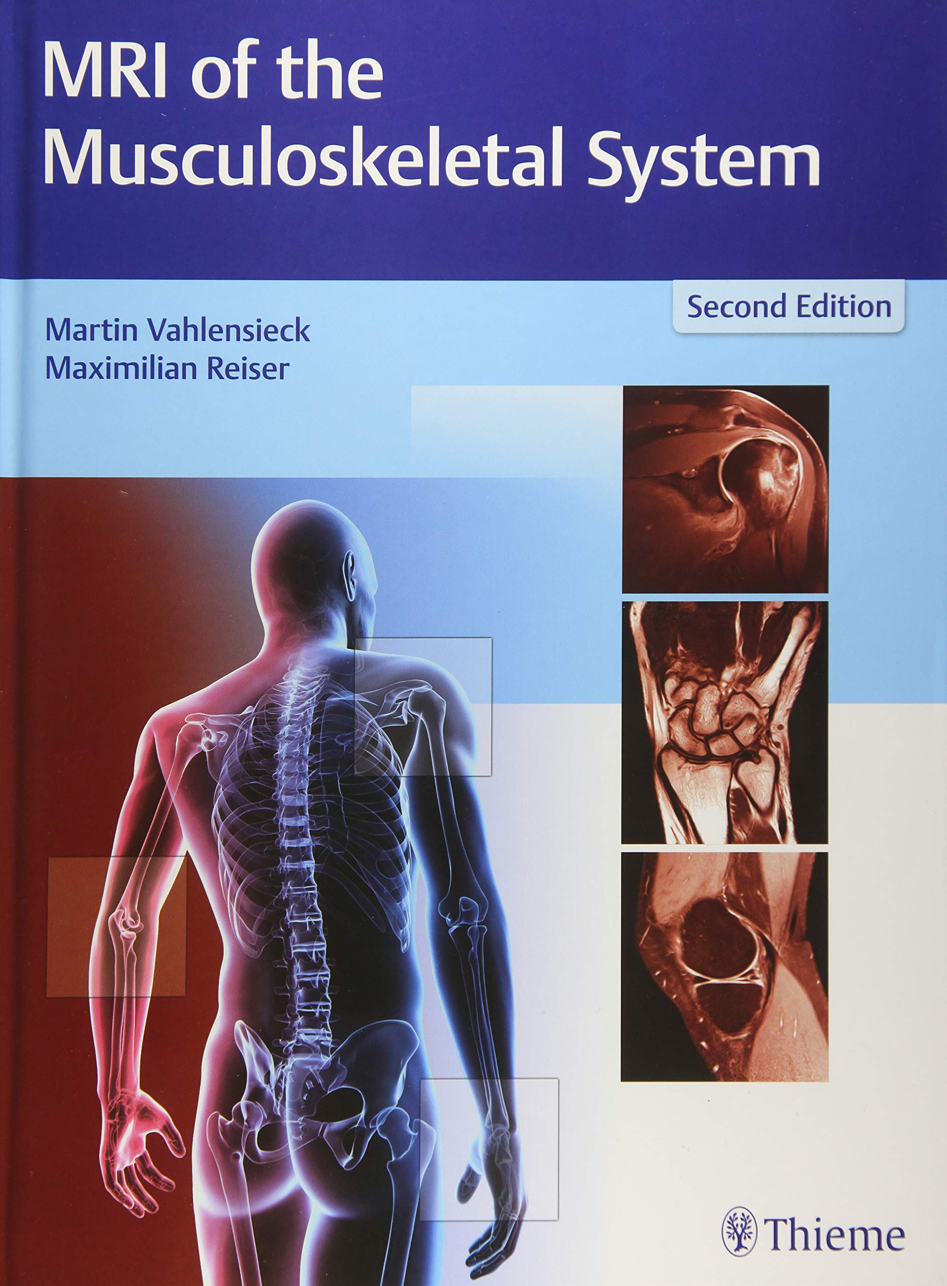 mri-of-the-musculoskeletal-system-2e