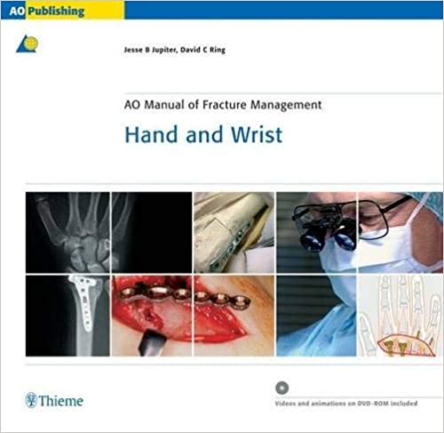 hand-and-wrist-ao-manual-of-fracture-management-1e