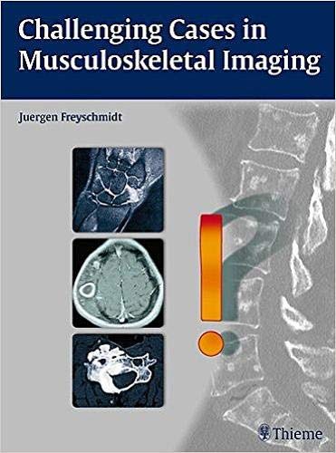 challenging-cases-in-musculoskeletal-imaging-1e