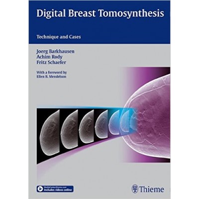 digital-breast-tomosynthesis-technique-and-cases-1e