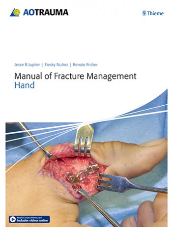 manual-of-fracture-management-hand-1e