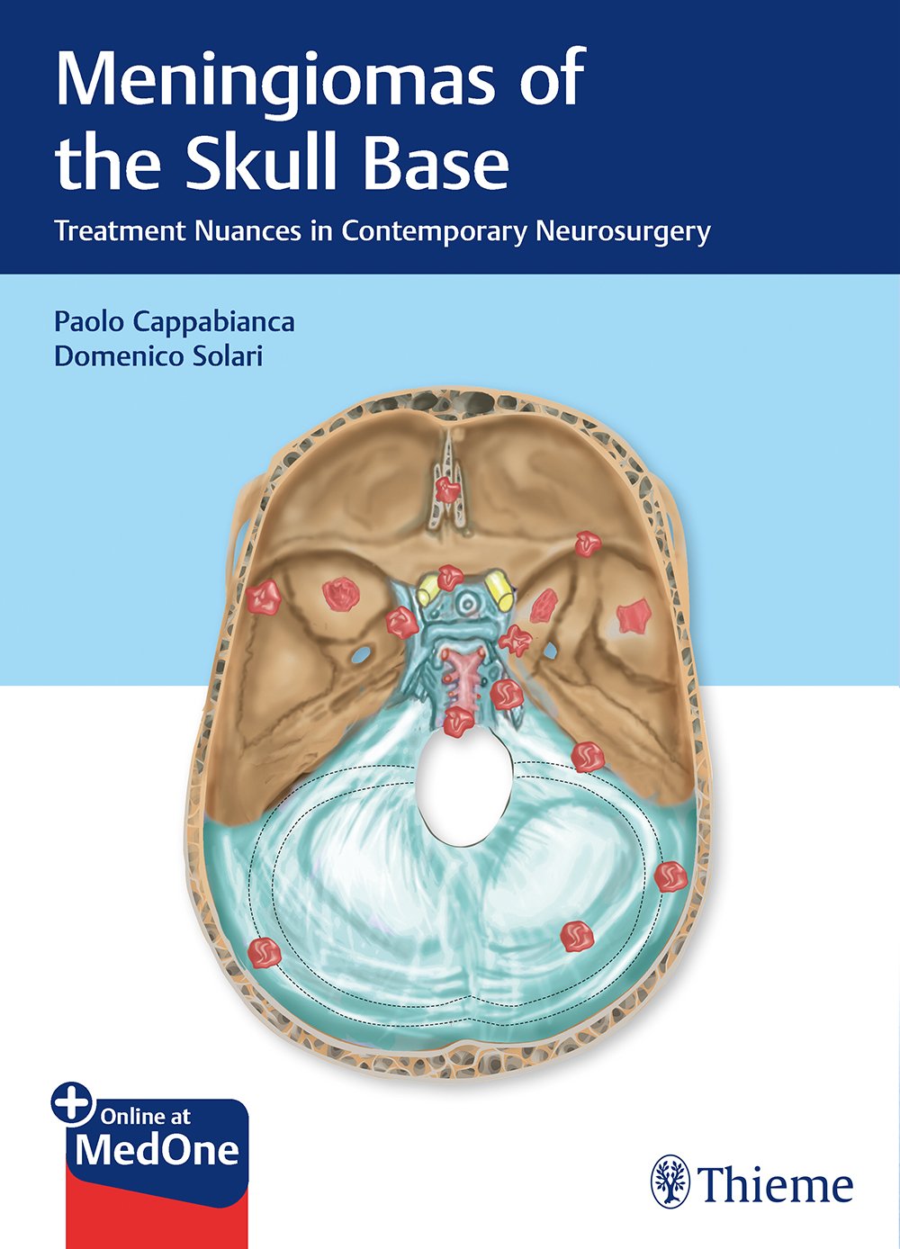 meningiomas-of-the-skull-base-treatment-nuances-in-contemporary-neurosurgery-1e