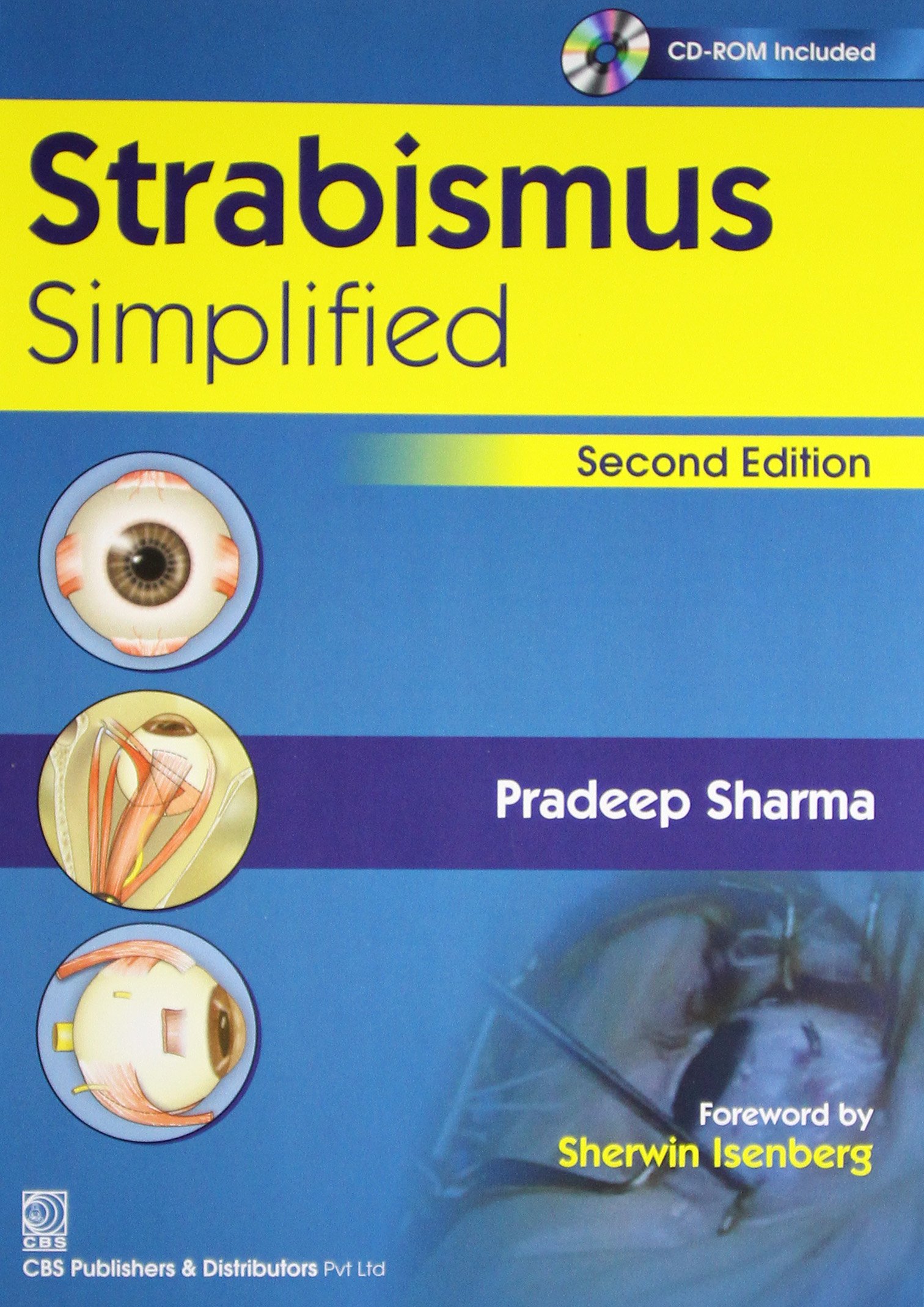 strabismus-simplified-2e-with-cd-pb