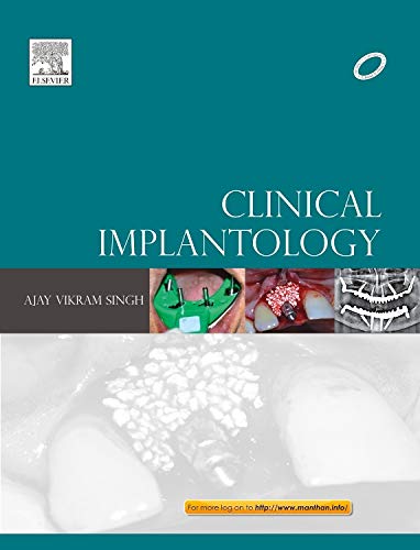 clinical-implantology-e-book-also-available-1e