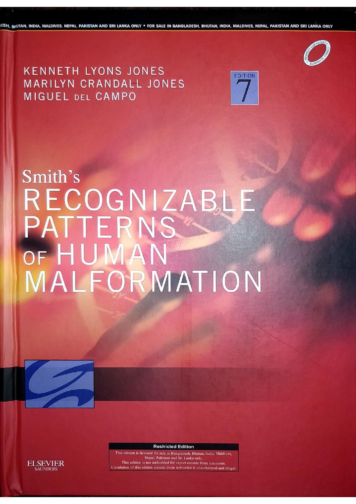 smiths-recognizable-patterns-of-human-malformation-expert-consult-online-and-print-7e