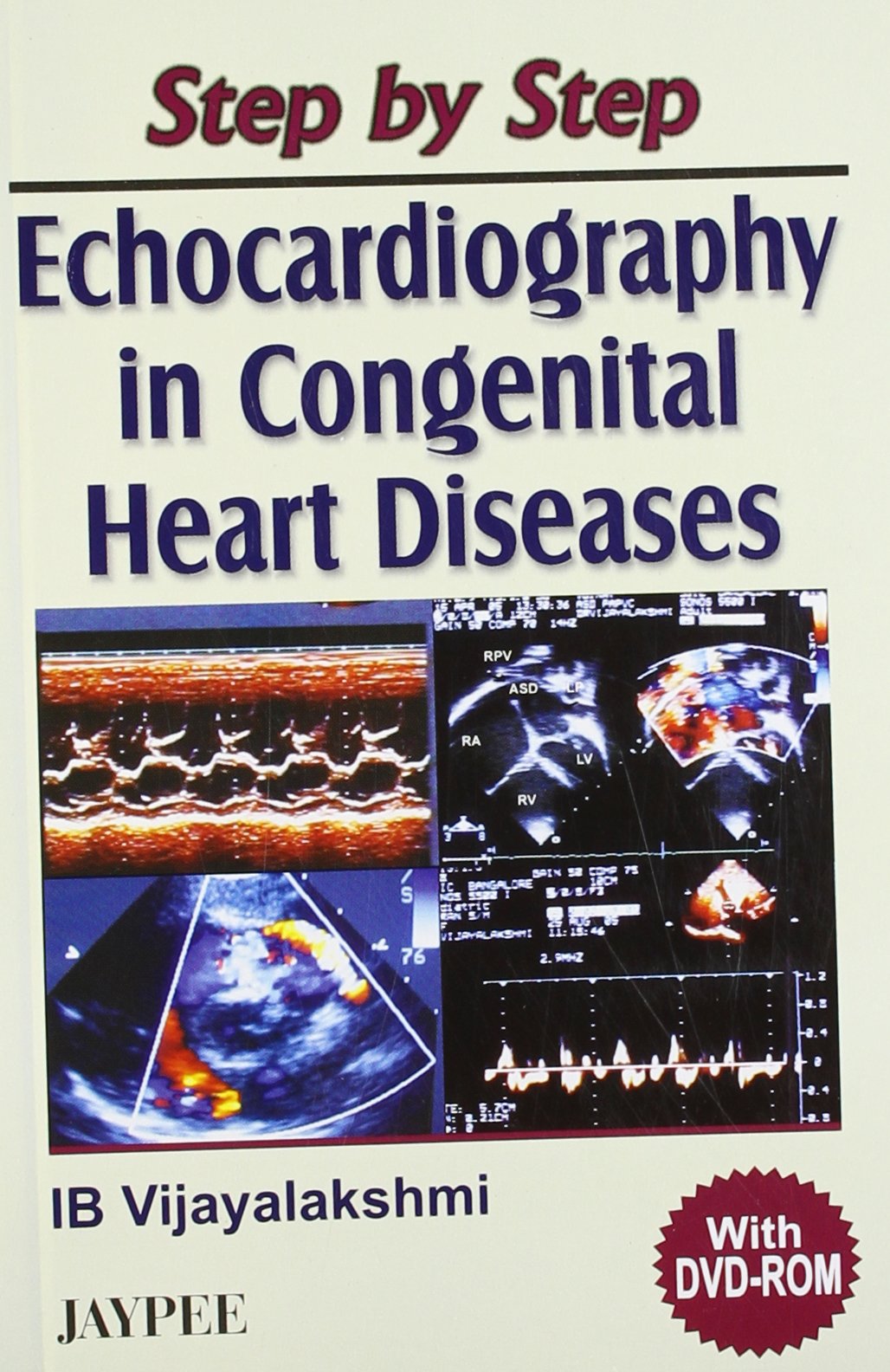 step-by-step-echocardiography-in-congenital-heart-diseases-with-dvd-rom